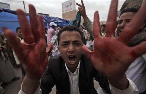 An anti-government protestor shouts with blood on his hands during clashes in Sanaa, Yemen, Friday, March 18, 2011. Yemeni security forces firing from rooftops and houses shot at tens of thousands of anti-government demonstrators, killing dozens as the protesters entered a downtown square in the capital to demand the ouster of their autocratic president. (AP Photo/Muhammed Muheisen)