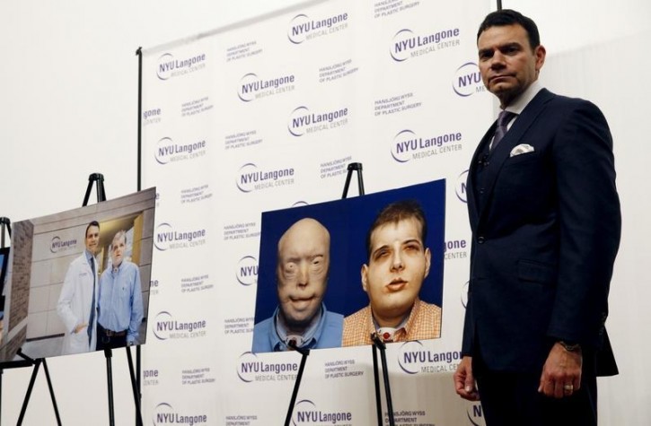 Dr. Eduardo D. Rodriguez, the Helen L. Kimmel Professor of Reconstructive Plastic Surgery at NYU Langone Medical Center poses for photographs at a news conference to announce the successful completion of the most extensive face transplant to date in the Manhattan borough of New York City, November 16, 2015. REUTERS