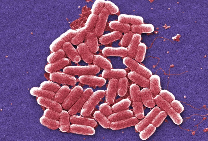 This 2006 colorized scanning electron micrograph image made available by the Centers for Disease Control and Prevention shows the O157:H7 strain of the E. coli bacteria. Bacteria with a special type of resistance to antibiotics have been found for a second time in the U.S., increasing worries that the country will soon see a superbug that cannot be treated with known medications. This case, first reported in a medical journal Monday, July 11, 2016, occurred a year earlier in New York. (Janice Carr/CDC via AP)