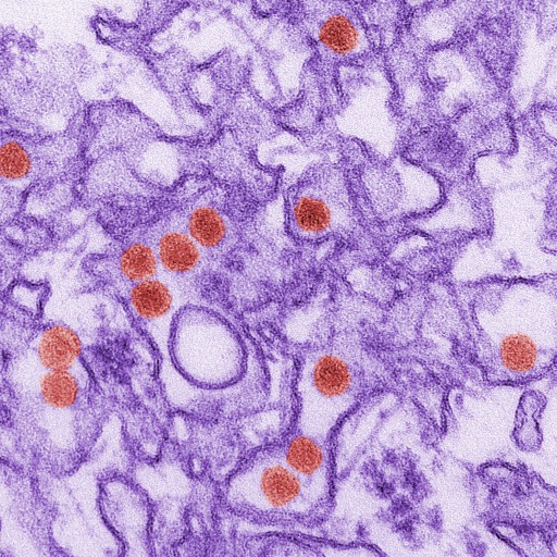 This is a digitally-colorized transmission electron micrograph (TEM) shows the Zika virus, in red, about 40 nanometers in diameter. (Cynthia Goldsmith/CDC via AP)